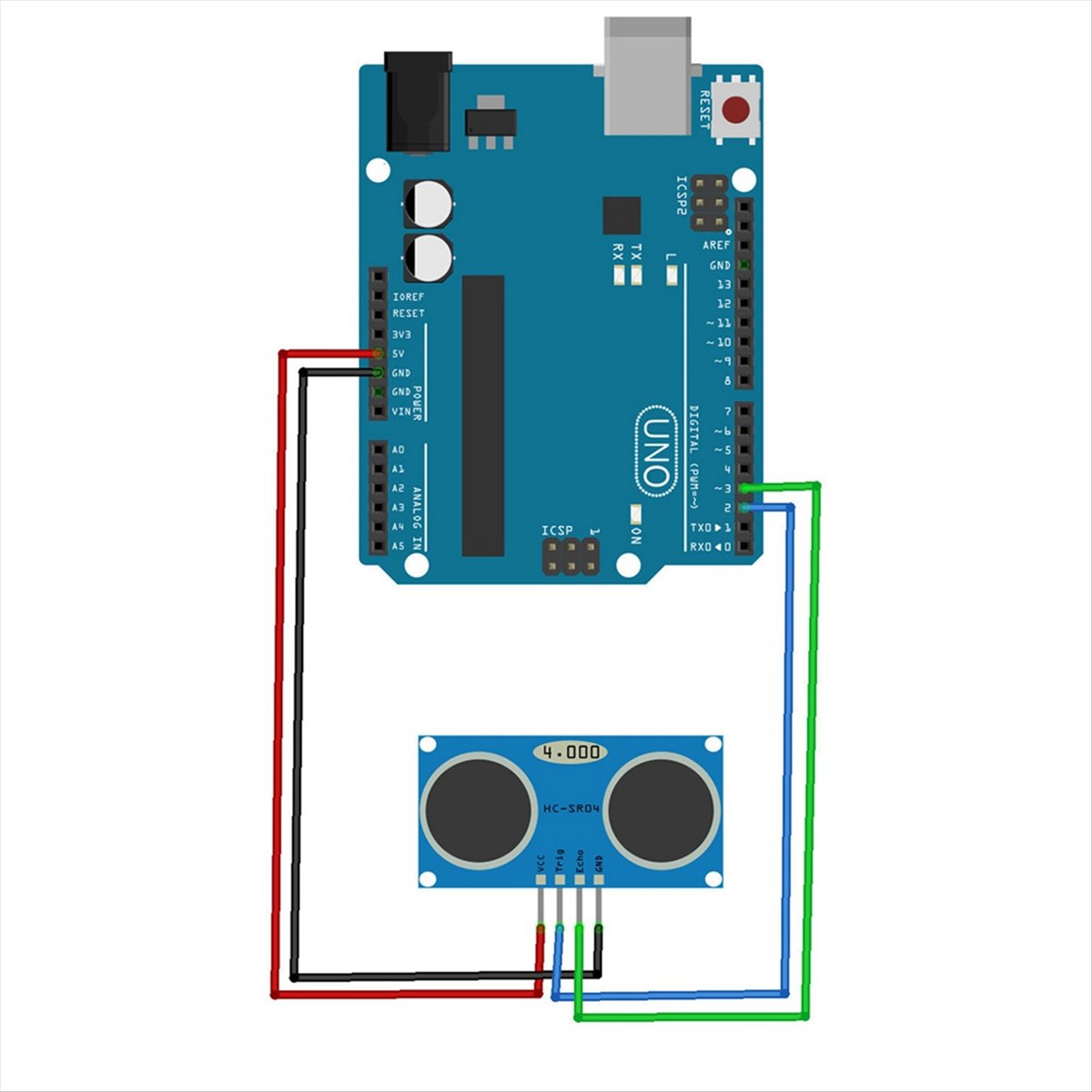 ABGN 1Pcs Ultrasonic Module -S - Ultrasonic Distance Sensor review and price